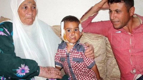 Kızıltepe'de Köpek Saldırısı Tehlikesi