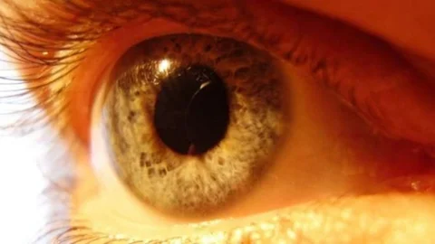 Adana'da Sarı Nokta Hastalığı Uyarısı