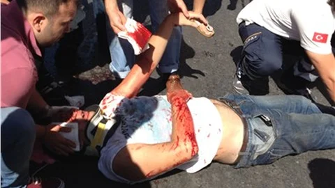 Yolun karşısına geçmeye çalışan çocuğa otomobil çarptı