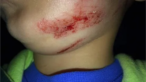 Belçika'da şok iddia Öğretmen minik öğrencinin boynuna ip bağladı, darp etti