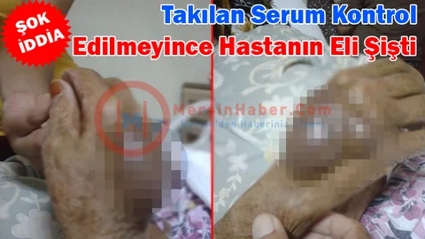 Şok İddia, Takılan Serum Kontrol Edilmeyince Hastanın Eli Şişti