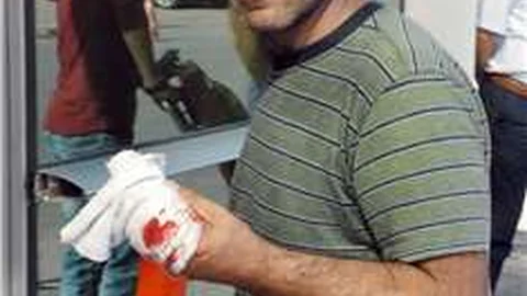 Kayseri’de acemi kasaplar acil servislere akın etti