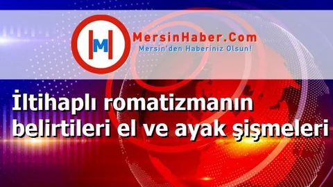 İltihaplı romatizmanın belirtileri el ve ayak şişmeleri