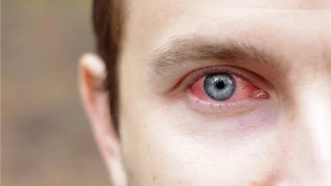 Dikkat! Göz Tansiyonu Körlüğe Neden Oluyor