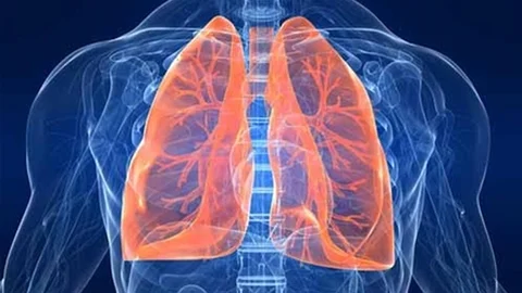 Tüberküloz Akciğer Kanserine Neden Oluyor! Tüberküloz Hastalığı Nedir Belirtileri Nelerdir