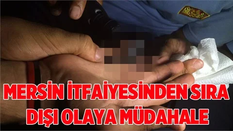 Şişen Parmaktaki Yüzüğü İtfaiye Çıkardı