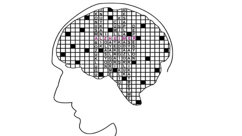 Türkiye’de 600 Bin Kişi Alzheimer Hastası