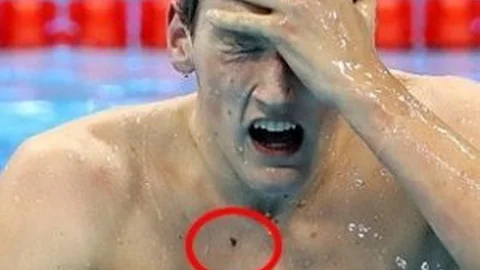 Hayranı Sayesinde Hayatı Kurtuldu