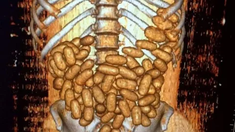 Midesinde Uyuşturucu Taşıyan 2 Kişi Son Anda Yakalandı