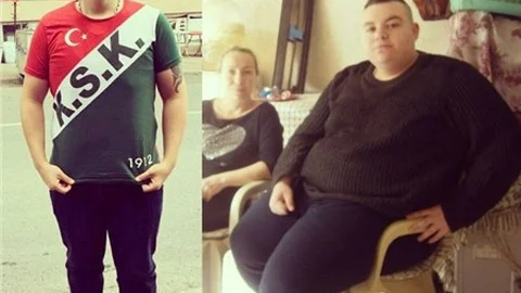Obezite Hastası 101 Kilo Verdi!
