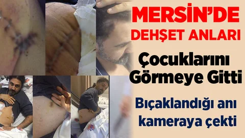 Tarsus’ta Çocuklarını Görmeye Gitti, Bıçaklı Saldırıya Uğradı