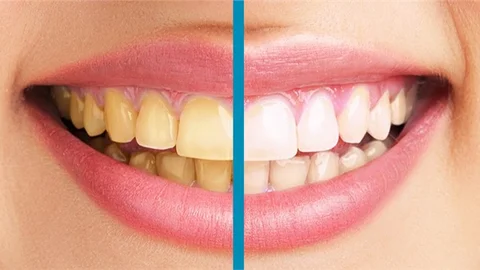 SARARMIŞ DİŞLERE DOĞAL BAKIM KÜRÜ