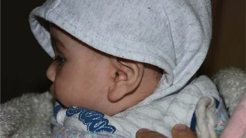 SURİYELİ BEBEK VE ANNEYİ FARELER KEMİRDİ