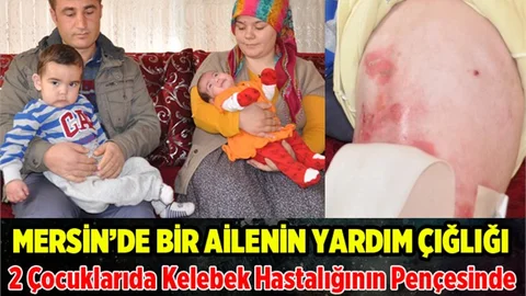 Mersin'de Kelebek Hastalığının Pençesindeki Aile Yardım Bekliyor