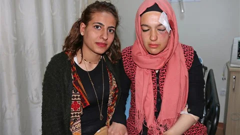 AK Parti'li kadınlara taşlı saldırı: 2 yaralı