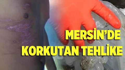 Sahilerde zehirli denizanası alarmı