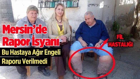 Fil Hastalığının Pençesindeki Adamın Rapor İsyanı