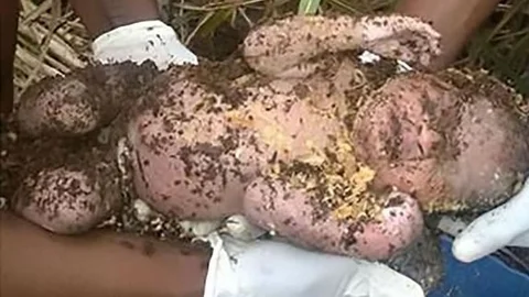 Mucize Olay.. 3 Gün Toprak Altında Kalan Bebek Hala Yaşıyordu