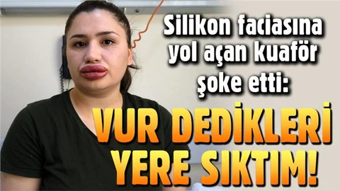 Merve Keleş'e silikon dolgu yapan kuaför: Vur dedikleri yere sıktım!