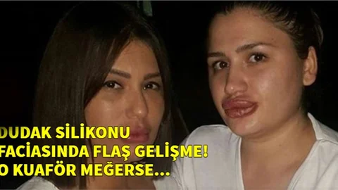 Dudak Silikonu Faciasında Flaş Gelişme