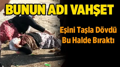 Eşinin Başına Taşla Vurarak Dövdüğü Kadın Ağır Yaralandı