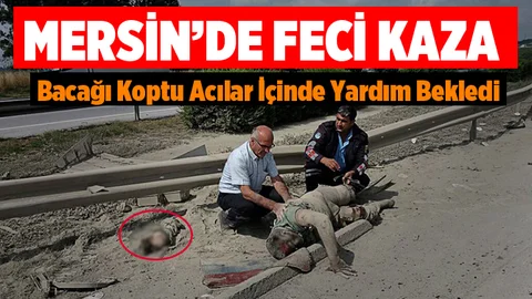 Mersin'de Feci Kaza. Sürücünün Bacağı Koptu