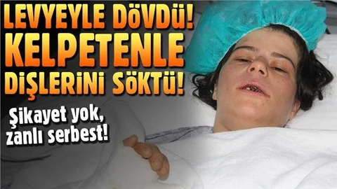 Suriyeli Kocadan Eşine Akıl Almaz İşkence