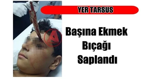 Mersin'de İnanılmaz Olay, Başına Ekmek Bıçağı Saplandı