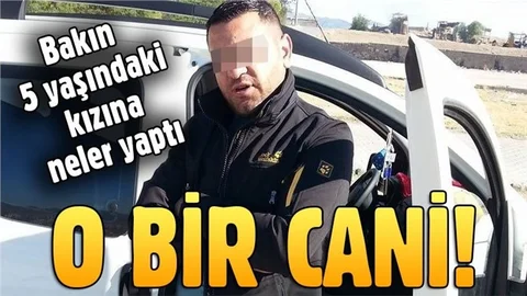 Altını ıslatan küçük kızının kolunu çakmakla yaktı