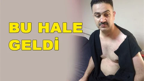 Mersin’de Sağlık Çalışanına Şiddet, Sendika Yöneticisinden Sağlık Personeline Şiddet