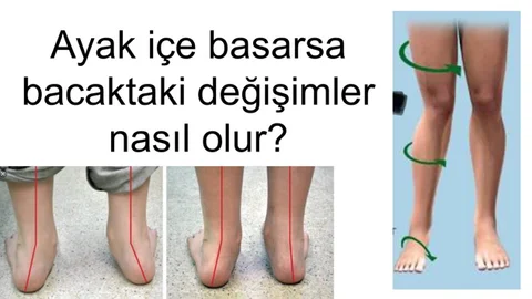 Paten Kullanımına Dikkat!