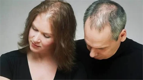 Farkında Olmayabilirsiniz Ancak, Saç, Sakal ve Kaş Koparmak Bir Hastalık!