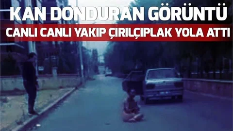 Kan Donduran Olay! Sevgilisini Canlı Canlı Yaktı