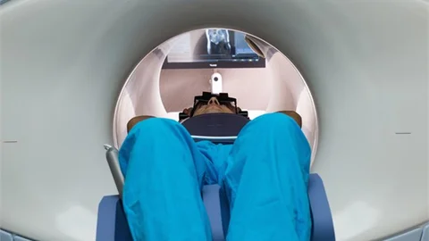 Korkutan Kanser Türünde Bir Önemli Adım Daha Atıldı! Pankreas Kanserinde Umut Veren Yöntem!