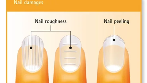 Kırılgan Tırnak Sendromuna Yakalananlara İyi Haber Artık Tırnaklarınız Kırılmayacak