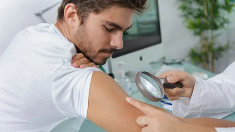 El ve Ayaklarınızı Kontrol Edin! Gizli Tehlike Benler