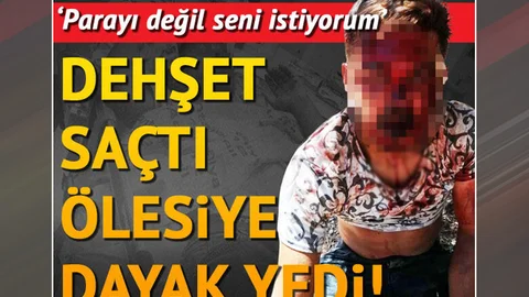 "Parayı Değil Seni İstiyorum" Dedi, Bıçakladı! Ölesiye Dayak Yedi