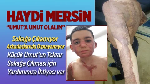 Haydi Mersin! Minik Umut'a Umut Olalım