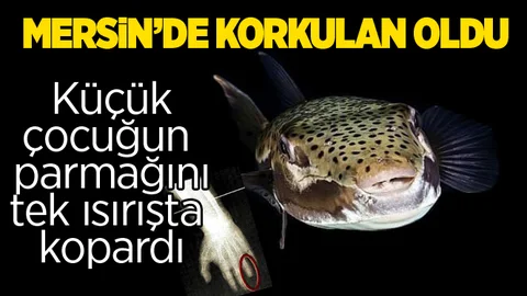 Mersin'de Balon Balığı Çocuğun Parmağını Kopardı
