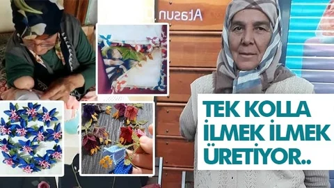 Tek Kolla Yaptığı İğne Oyası İşlerini Satarak Geçimini Sağlıyor