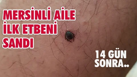 Acil Serviste Çıkarıldı