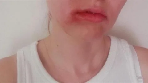 Mersin İl Sağlık Müdürlüğünden Açıklama