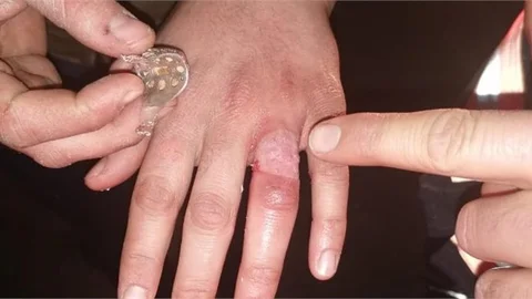 Parmağı Yüzüğe Sıkışan Yolcunun Yardımına İtfaiye Yetişti