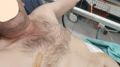 MERSİN'DE KOCASINI 2 YERİNDEN BIÇAKLADI