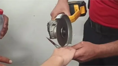 PARMAĞIA SIKIŞAN MAKAS HALKASI İTFAİYE EKİPLERİ TARAFINDAN ÇIKARTILDI