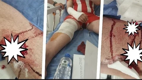 MERSİN'DE 68'LER BARIŞ ORMANINDA BAŞIBOŞ KÖPEKLERİN SALDIRISINA UĞRADI