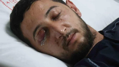 Sakarya'da düğün eğlencesinde havai fişek kazası