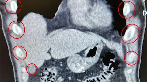 Bitlis'te uyuşturucu operasyonu