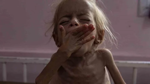 Gazze'de açlık nedeniyle iki kişi hayatını kaybetti