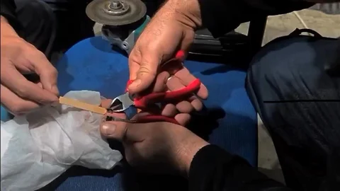 Çankırı'da yüzük parmağına sıkıştı